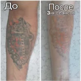 Студия татуировки и удаления тату Serdolik фото 5
