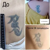 Студия татуировки и удаления тату Serdolik фото 4